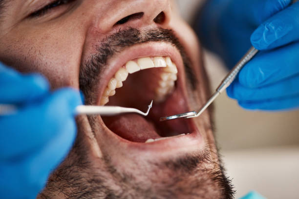 Best Chipped Tooth Repair Near Me  in Wadesboro, NC